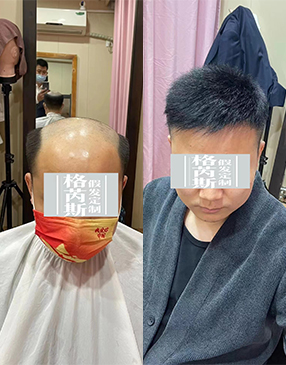 制作好后，根據(jù)您的頭型量身剪裁，設(shè)計(jì)您喜歡的發(fā)型