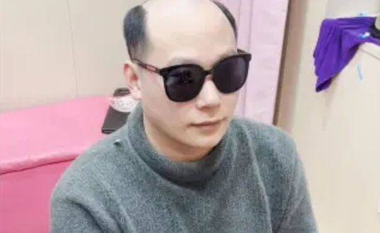 定制假發(fā)的意義在于符合自己的審美、穿搭、年齡